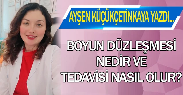 BOYUN DÜZLEŞMESİ NEDİR VE TEDAVİSİ NASIL OLUR?
